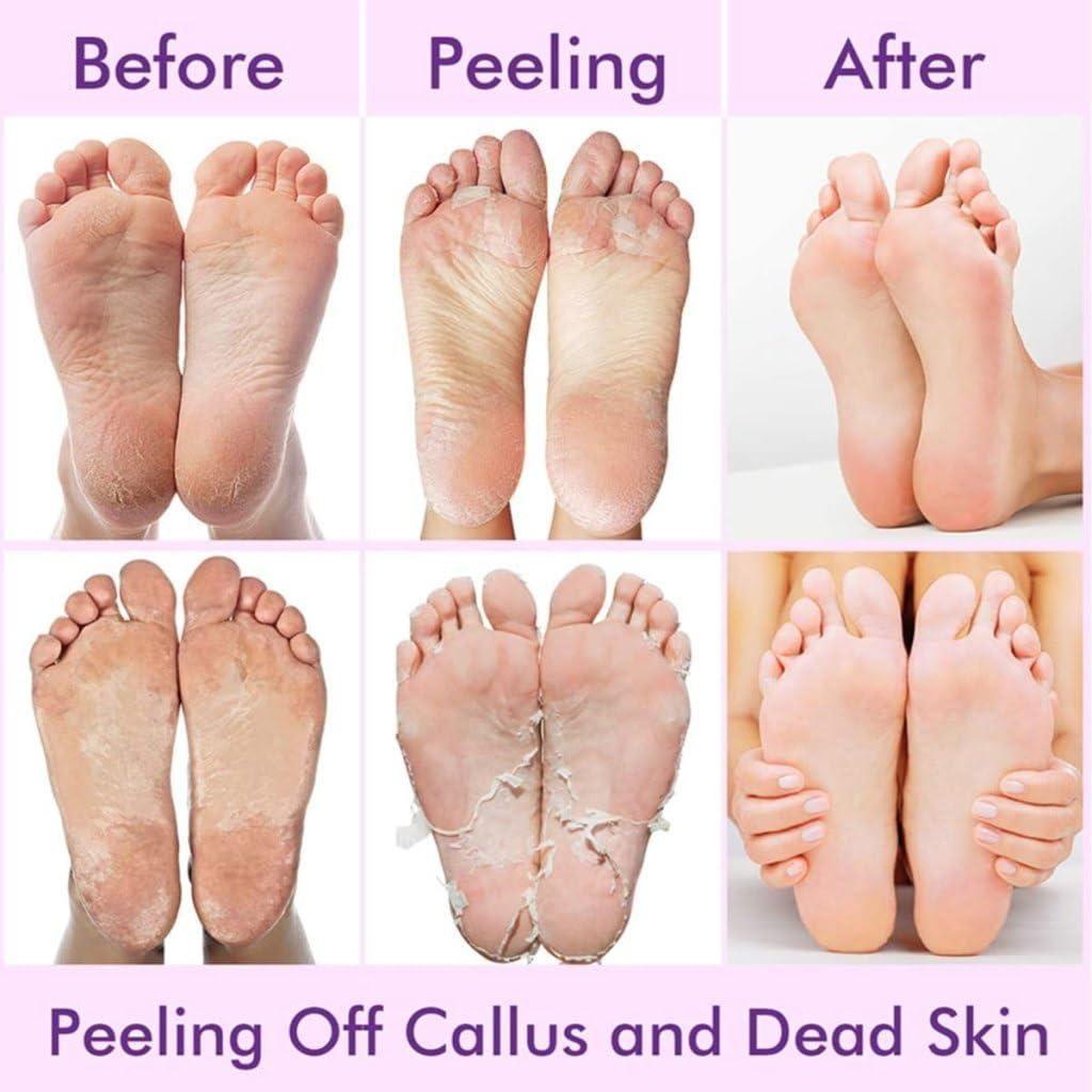 Exfoliating Foot Mask Socks – Deep Hydration & Dead Skin Removal Pedicure Care