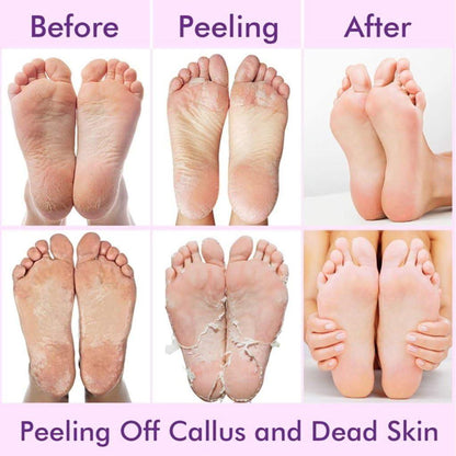 Exfoliating Foot Mask Socks – Deep Hydration & Dead Skin Removal Pedicure Care
